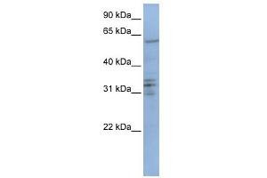 CENPB antibody used at 1 ug/ml to detect target protein. (CENPB 抗体  (C-Term))