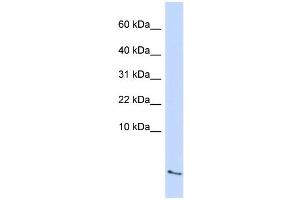 WB Suggested Anti-SAA4 Antibody Titration:  0. (SAA4 抗体  (Middle Region))