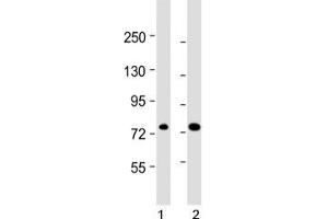 ABCD1 antibody western blot analysis in human 1) 293/T17 and 2) HL-60 lysate.