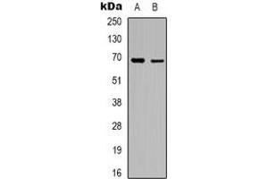 Western blot analysis of RhoBTB3 expression in A10 (A), K562 (B) whole cell lysates. (RHOBTB3 抗体)