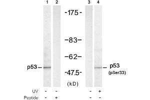 Image no. 1 for anti-Tumor Protein P53 (TP53) (Ser33) antibody (ABIN319306) (p53 抗体  (Ser33))