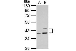 WB Image Sample (30 ug of whole cell lysate) A: Raji B: K562 10% SDS PAGE antibody diluted at 1:1000 (APOL1 抗体)