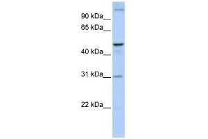 ACBD5 antibody used at 1 ug/ml to detect target protein.