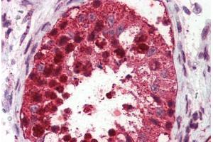 Testis, Human: Formalin-Fixed, Paraffin-Embedded (FFPE) (USP2 抗体  (C-Term))