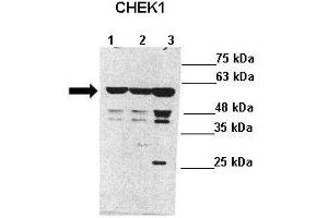 Lanes : Lane 1: 40ug SH-SY5Y lysateLane 2: 40ug SH-SY5Y lysateLane 3: 40ug HEK293T lysate  Primary Antibody Dilution :  1:1000   Secondary Antibody : Anti-rabbit-HRP  Secondary Antibody Dilution :  1:8000  Gene Name : CHEK1  Submitted by : Anonymous (CHEK1 抗体  (Middle Region))