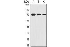 Western blot analysis of PiT2 expression in HepG2 (A), mouse kidney (B), rat liver (C) whole cell lysates. (SLC20A2 抗体)