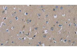 Immunohistochemistry of paraffin-embedded Human brain using FAAH Polyclonal Antibody at dilution of 1:50 (FAAH 抗体)