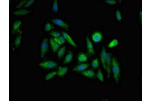 Immunofluorescent analysis of Hela cells using ABIN7156293 at dilution of 1:100 and Alexa Fluor 488-congugated AffiniPure Goat Anti-Rabbit IgG(H+L) (ITPR1 抗体  (AA 1707-1966))