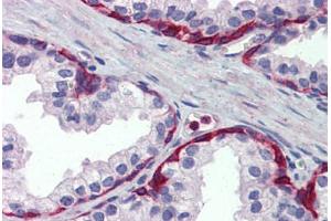 Human Prostate: Formalin-Fixed, Paraffin-Embedded (FFPE) (METTL7A 抗体  (Internal Region))