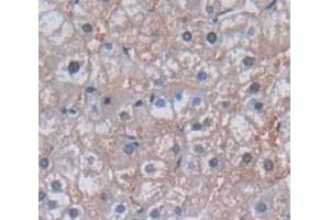 IHC-P analysis of Human Tissue, with DAB staining. (GGT1 抗体  (AA 122-299))