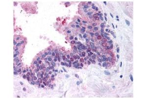 Image no. 5 for anti-Fanconi Anemia, Complementation Group D2 (FANCD2) (N-Term) antibody (ABIN363390)