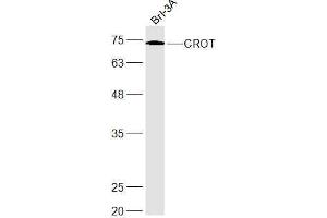 Brl-3A lysates probed with CROT Polyclonal Antibody, Unconjugated  at 1:300 dilution and 4˚C overnight incubation. (CROT 抗体  (AA 201-275))
