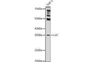 Western blot analysis of extracts of THP-1 cells, using LAT Rabbit pAb (ABIN6128175, ABIN6143099, ABIN6143100 and ABIN6221291) at 1:1000 dilution.