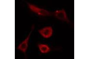 ABIN6274492 staining Hela cells by IF/ICC. (C1orf35 抗体  (C-Term))