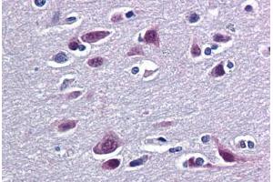 Human Brain, Cortex: Formalin-Fixed, Paraffin-Embedded (FFPE) (RBM9 抗体  (AA 1-100))