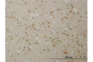 Image no. 1 for anti-Transducin (Beta)-Like 1X-Linked (TBL1X) (AA 478-578) antibody (ABIN598960) (TBL1X 抗体  (AA 478-578))