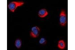 Immunofluorescent analysis of PIP5K staining in HepG2 cells. (PIKFYVE 抗体  (N-Term))