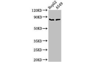 Western Blot Positive WB detected in: HepG2 whole cell lysate, A549 whole cell lysate All lanes: CFB antibody at 2. (Complement Factor B 抗体  (AA 23-761))