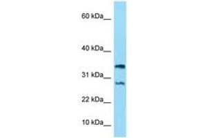 Image no. 1 for anti-NADH Dehydrogenase (Ubiquinone) 1 alpha Subcomplex, 11, 14.7kDa (NDUFA11) (AA 15-64) antibody (ABIN6748211) (NDUFA11 抗体  (AA 15-64))