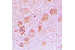 Immunohistochemical analysis of RPL17 staining in human brain formalin fixed paraffin embedded tissue section. (RPL17 抗体  (Center))