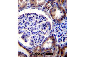 Immunohistochemistry (Paraffin-embedded Sections) (IHC (p)) image for anti-RPTOR Independent Companion of mTOR, Complex 2 (RICTOR) (AA 1617-1650), (C-Term) antibody (ABIN391385)