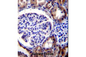 RICTOR Antibody (C-term) (ABIN391385 and ABIN2841393) immunohistochemistry analysis in formalin fixed and paraffin embedded human kidney tissue followed by peroxidase conjugation of the secondary antibody and DAB staining.