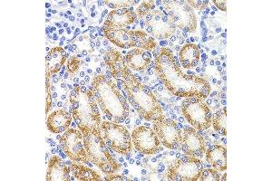 Immunohistochemistry of paraffin-embedded rat kidney using HMGCL antibody.