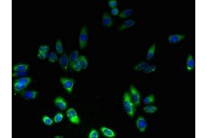 Immunofluorescent analysis of HepG2 cells using ABIN7152887 at dilution of 1:100 and Alexa Fluor 488-congugated AffiniPure Goat Anti-Rabbit IgG(H+L)