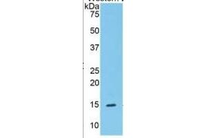 WB of Protein Standard: different control antibodies  against Highly purified E.