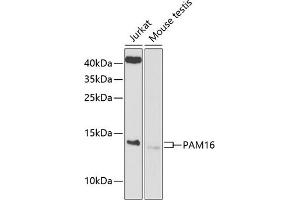 Western blot analysis of extracts of various cell lines, using P antibody (ABIN6133374, ABIN6145200, ABIN6145201 and ABIN6225214) at 1:1000 dilution. (MAGMAS 抗体  (AA 21-125))