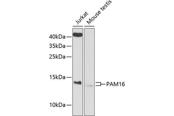 MAGMAS Antikörper  (AA 21-125)