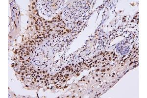 IHC analysis of PHF21A using anti-PHF21A antibody (ABIN6719353). (PHF21A 抗体  (AA 1-97))
