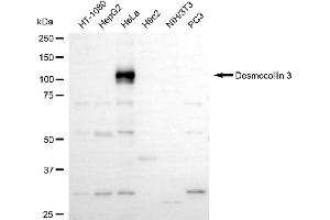 Western blotting analysis using desmocollin 3 antibody (ABIN7798316).