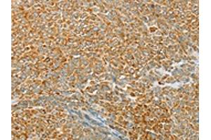 Immunohistochemistry (IHC) image for anti-Tyrosine-Protein Phosphatase Non-Receptor Type 22 (PTPN22) antibody (ABIN7130771)