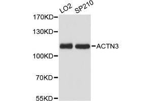 Western blot analysis of extracts of various cell lines, using ACTN3 antibody (ABIN6290056) at 1:3000 dilution. (ACTN3 抗体)