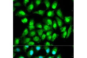 Immunofluorescence analysis of HeLa cells using RAN Polyclonal Antibody (RAN 抗体)