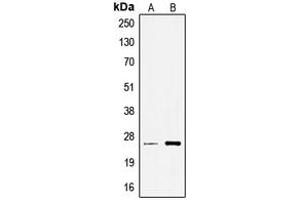 Western blot analysis of TCEAL6 expression in A549 (A), Jurkat (B) whole cell lysates.