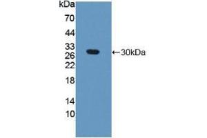 Western blot analysis of recombinant Mouse GAMT. (GAMT 抗体  (AA 2-236))