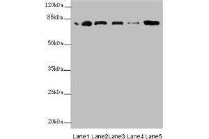 Western blot All lanes: ZBTB48 antibody at 0. (ZBTB48 抗体  (AA 1-280))