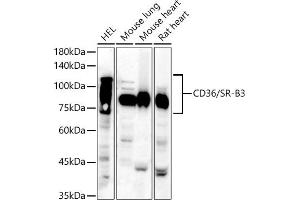 Western blot analysis of extracts of various cell lines, using CD36/SR-B3 antibody (ABIN6132248, ABIN6138173, ABIN6138174 and ABIN6221473) at 1:810 dilution. (CD36 抗体  (AA 30-270))