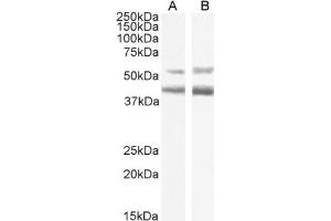 Western Blot using anti-CCR4 antibody KW-0761 (Mogamulizumab). (Recombinant CCR4 (Mogamulizumab Biosimilar) 抗体)