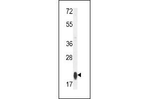 Western blot analysis of RT25 Antibody (C-term) (ABIN653808 and ABIN2843083) in MCF-7 cell line lysates (35 μg/lane). (MRPS25 抗体  (C-Term))