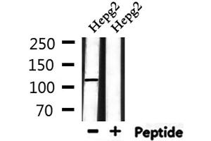 Western blot analysis of extracts from HepG2, using UBAP2L Antibody. (UBAP2L 抗体  (Internal Region))