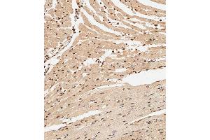 Immunohistochemical analysis of paraffin-embedded Mouse heart tissue using (ABIN6243913 and ABIN6577986) performed on the Leica® BOND RXm. (NK2 Homeobox 5 抗体  (AA 98-133))