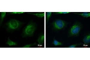 ICC/IF Image CACNB4 antibody [C3], C-term detects CACNB4 protein at cytoplasm by immunofluorescent analysis. (CACNB4 抗体  (C-Term))