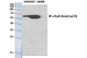 Western Blot (WB) analysis of specific cells using Acetyl-NFkappaB-p65 (K310) Polyclonal Antibody. (NF-kB p65 抗体  (acLys310))