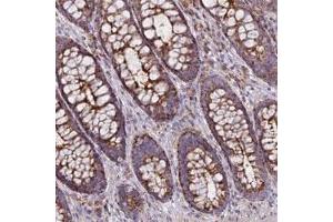 Immunohistochemical staining of human rectum with CHMP4B polyclonal antibody  shows strong granular cytoplasmic positivity in glandular cells. (CHMP4B 抗体)