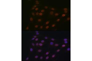 Immunofluorescence analysis of C6 cells using RanG Rabbit mAb (ABIN7269846) at dilution of 1:100 (40x lens). (RANGAP1 抗体)