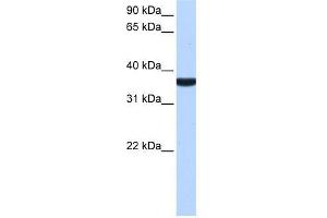 TP53I13 antibody used at 0. (TP53I13 抗体  (C-Term))