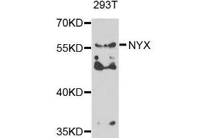 Western blot analysis of extracts of 293T cells, using NYX antibody. (Nyctalopin 抗体  (AA 282-481))